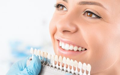 The 3 Best and Safest Teeth Whitening Options