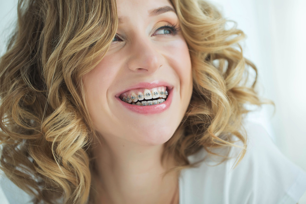 A pretty woman smiling with metal braces.