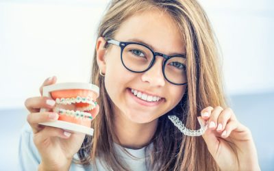 Invisalign Vs Braces – Pros and Cons of Each