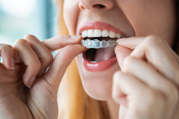 A woman putting on her Invisalign aligners.